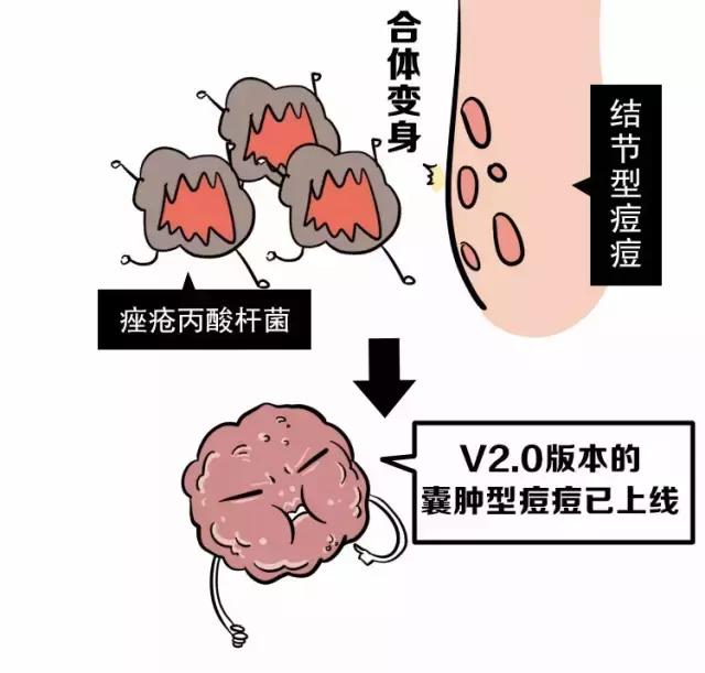 angelababy痘痘,angelababy额头冒巨痘
