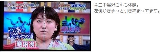 哪些面部运动可以快速消除法令纹,脸部运动真的可以改善法令纹吗