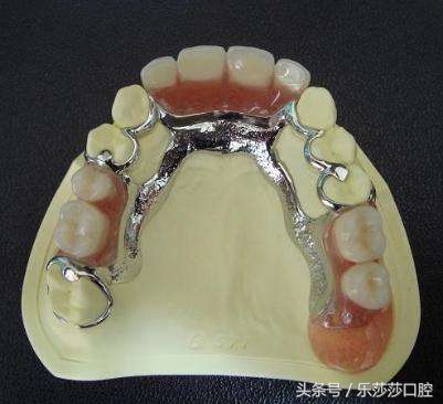 镶牙真的是一种错误吗,镶牙很假吗