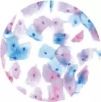 宫颈癌筛查书,宫颈癌筛查报告有几张单子