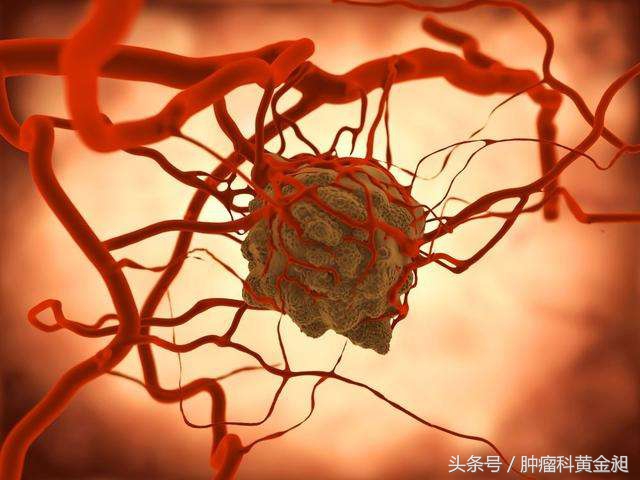 肝癌介入栓塞化疗的副作用,肿瘤介入手术栓塞血管