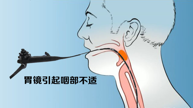 有胃炎患者胃镜多久做一次,胃炎患者建议多久做一次胃镜