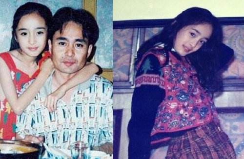 车晓鼻子现在好了吗,车晓整鼻子了吗