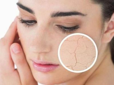 春天上火应该喝什么保健茶,春天干燥上火喝什么茶