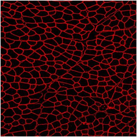 慈善公益投资机构,慈善公益创投