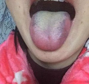 十人九湿湿气除百病消是真的吗,十人九湿湿气不除