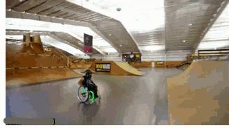 抽脂后胖了凹凸不平,严重抽脂减肥后图片