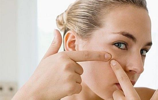 如何去粉刺最简单的方法,怎么去粉刺最简单的方法