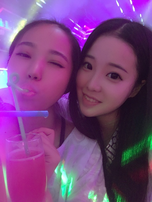 全切双眼皮疤痕增生多久可以恢复,全切双眼皮恢复过程经历真实