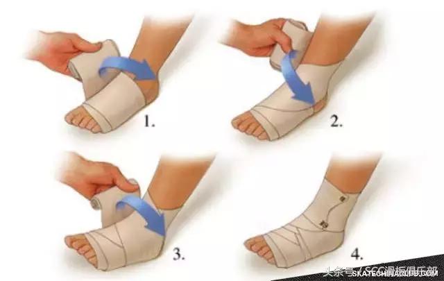 怎么快速恢复崴伤的脚踝,如何彻底治愈脚踝陈旧性扭伤