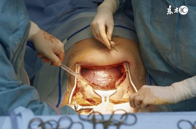 当分娩“内检”遇上男医生!竟有99%的产妇都说求之不得!