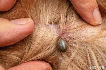 踏青遭蜱虫叮咬千万别硬拔,踏青出游被蜱虫咬了怎么办