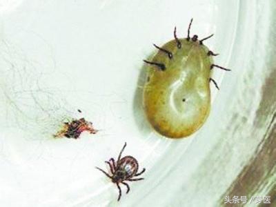 踏青怎么防止蜱虫,踏青被蜱虫咬