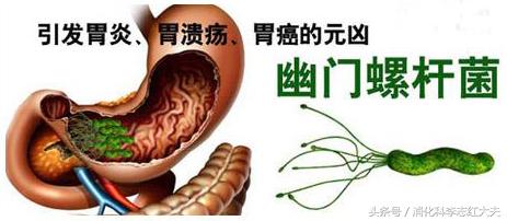 经常感到头晕乏力心慌,胃病引起心慌心悸头晕睡眠不好吗