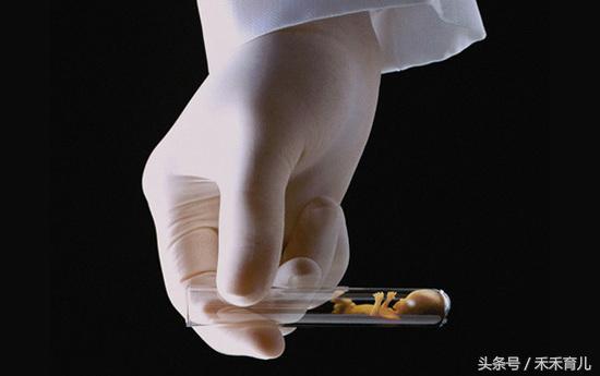 试管婴儿智商普遍不高是真的吗,试管婴儿智商低