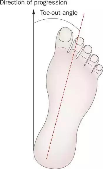 八字脚对跑步有影响吗,跑步时八字脚产生原因及纠正方法