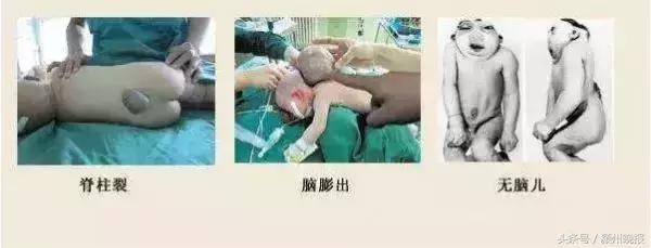 阜阳签约116个项目,阜阳签约新项目