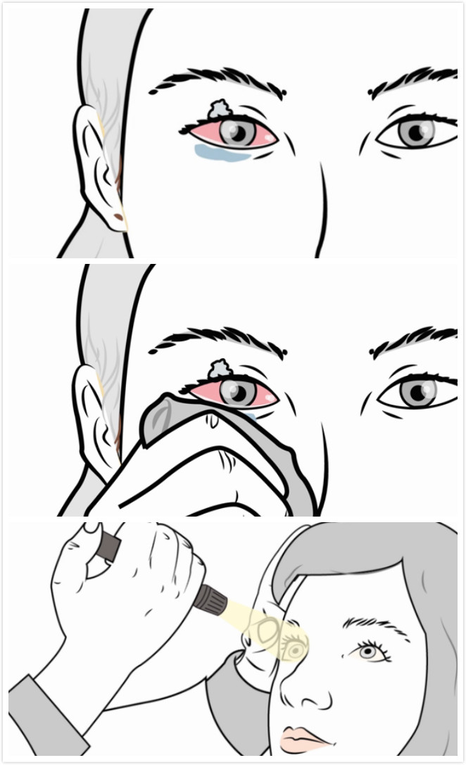 去除强力胶最有效的方法,强力胶怎么去除最快方法小妙招