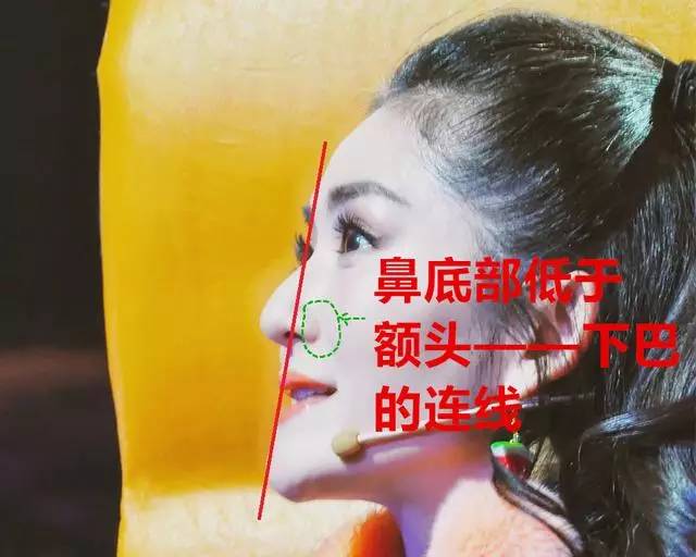 美女与野兽|天生法令纹只能靠整容吗?那是因为你没看这篇!