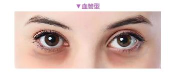 黑眼圈折磨我这么久，今天该认真聊聊了