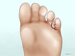 糖友出现了并发症信号怎么办,糖友早期并发症的表现