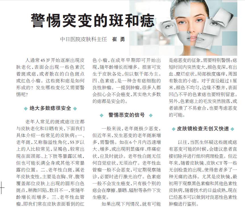 中日医院皮肤科,皮肤科医生痣和斑的区别
