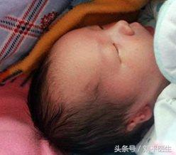 新生儿耳朵畸形耳道狭窄怎么治疗,宝宝耳畸形耳道闭锁需要什么检查