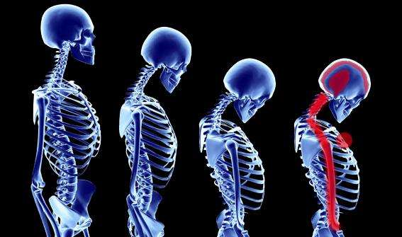 颈椎病犯了吃的西药是什么药,布洛芬对颈椎病有治疗作用吗