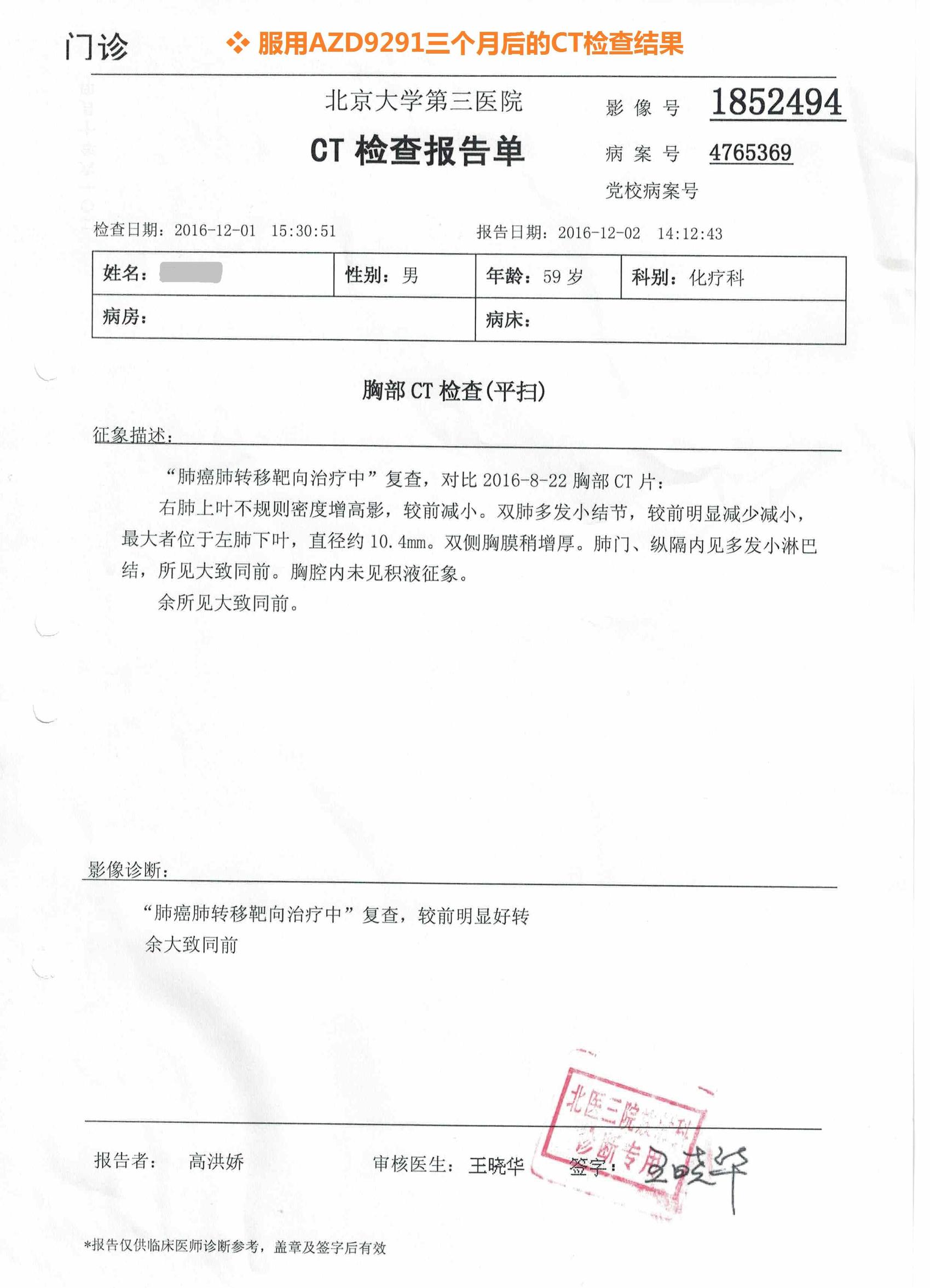 azd9291奥希替尼,azd9291中国购买价格