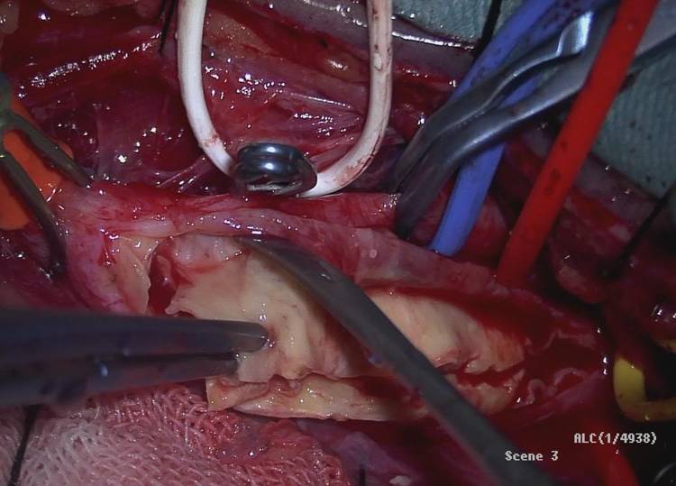 脑供血不足怎么防治,脑供血不足常敲打3个穴位