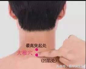 一味中药解除湿疹,湿疹千万不要慌可以用这几个方法