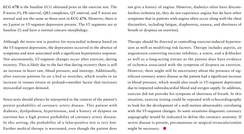 读心有术视频讲解,长期心电图提示下壁st段轻度压低