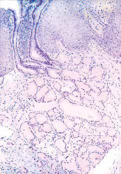 内镜做病理分析大概多久,作为一个医生太感性怎么办