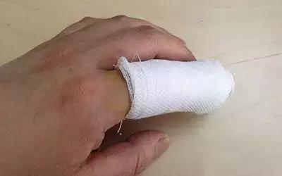 我滴个天呐！男子被木屑刺伤一个月后突发重病险丧命！