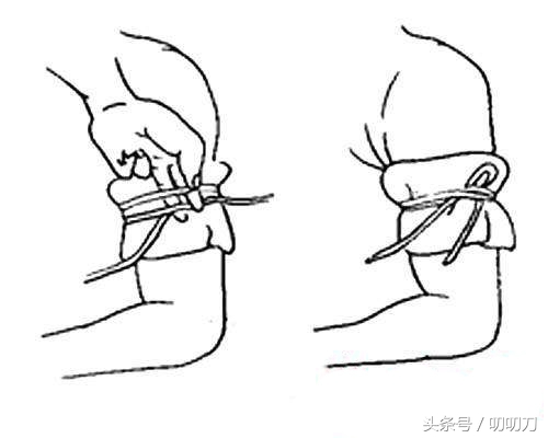 被刀割伤时的几个简易止血方法，关键时刻或许可以救命！