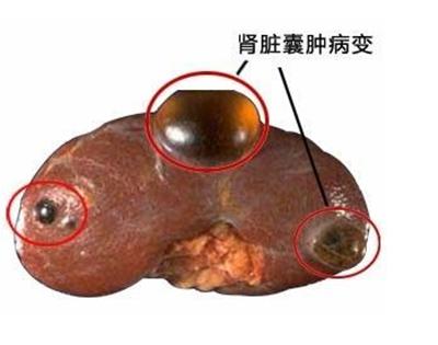 柴归汤怎么治寒湿凝滞,经方柴归汤