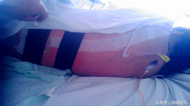 我的无痛顺产经历希望对即将“卸货”的你有一点帮助