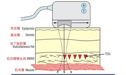 杨幂李菲儿,王鸥和李菲儿