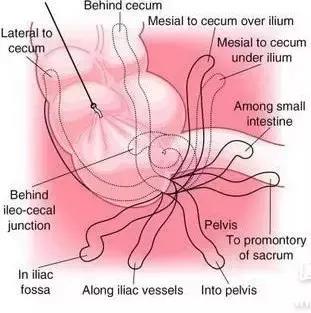 腹痛的辨证范畴,腹痛鉴别
