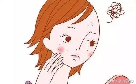 17岁男孩青春痘最好治疗方法,治疗青春痘痤疮的方法