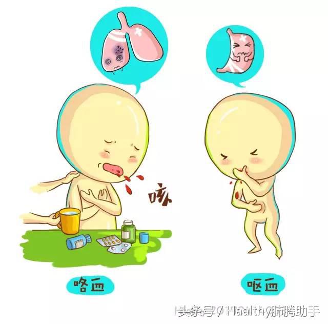 患者发生大咯血时应采取什么卧位,病人大咯血发作时应如何处理