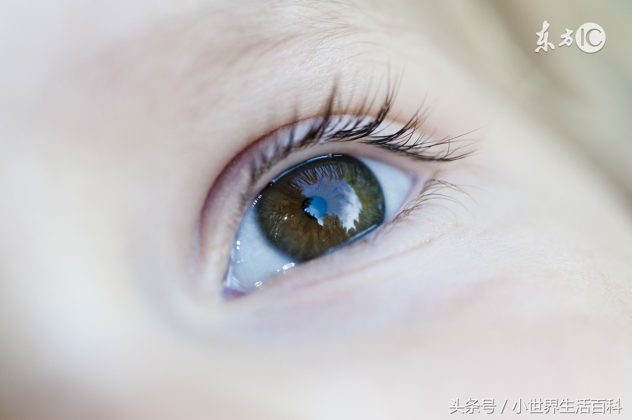 戴美瞳有什么可怕的后果,戴美瞳很吓人原因