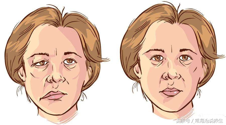 胆囊息肉应该怎么办？面瘫用什么办法比较好？