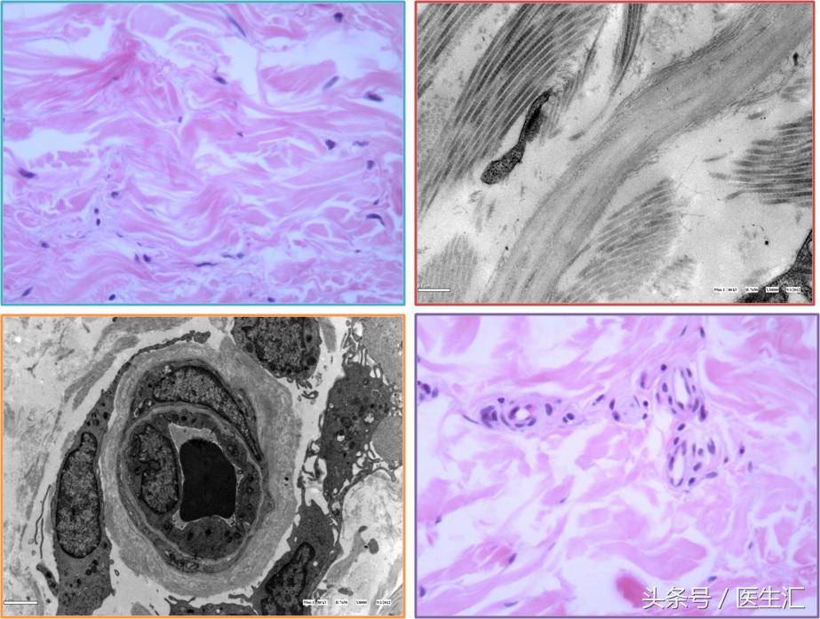 神经内科疾病诊断公式,神经系统疾病的诊断思路及步骤