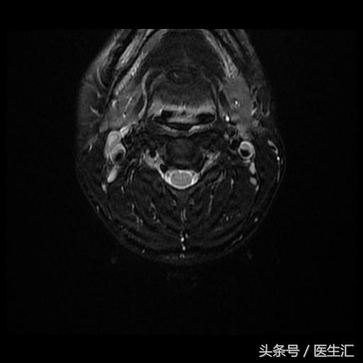神经内科疾病诊断公式,神经系统疾病的诊断思路及步骤