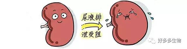 肾积水——尿都堵了，肾怎么能好