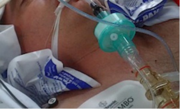 急需熊猫血?《外科风云》里的低温疗法并没有什么用