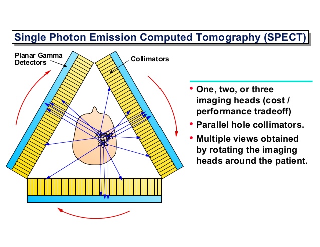 什么是ect肺通气显像,什么是ect