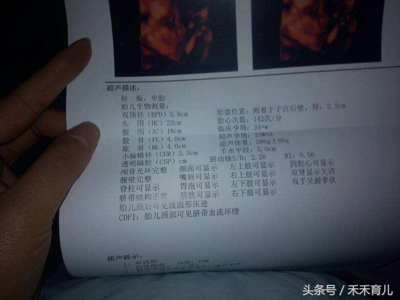 孕37周脐带绕颈2周还能绕回来么,怀孕37周胎儿脐带绕颈2周怎么纠正