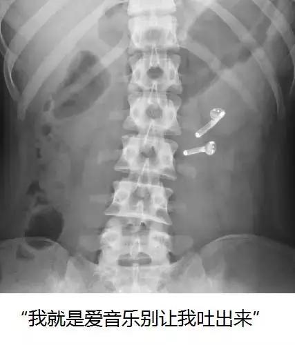 狗狗便血一般是什么原因,狗狗便血是感染哪种寄生虫